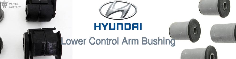 Discover Hyundai Control Arm Bushings For Your Vehicle