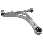 Order SUSPENSIA CHASSIS - X47CJ1096 - Control Arm For Your Vehicle