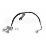 Order Front Brake Hose by SUNSONG NORTH AMERICA - 2203899 For Your Vehicle