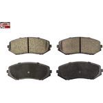 Order Front Ceramic Pads by PROMAX - 10-1188 For Your Vehicle