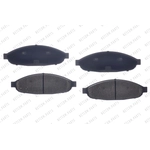 Order Front Ceramic Pads by RS PARTS - RSD997CH For Your Vehicle