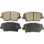 Order Front Semi Metallic Pads by PROMAX - 11-1815 For Your Vehicle