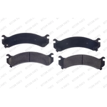 Order Front Semi Metallic Pads by RS PARTS - RSD784AM For Your Vehicle