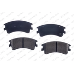 Order Front Semi Metallic Pads by RS PARTS - RSD957MH For Your Vehicle