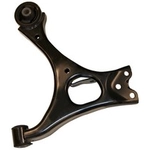 Order SUSPENSIA CHASSIS - X17CA0646 - Front Right Lower Suspension Control Arm For Your Vehicle