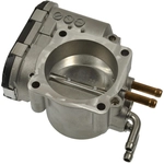 Order BWD AUTOMOTIVE - S20154 - Fuel Injection Throttle Body For Your Vehicle