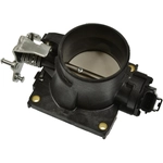 Order BWD AUTOMOTIVE - S20170 - Fuel Injection Throttle Body For Your Vehicle