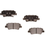 Order PROFUSION - PMD1544 - Rear Semi Metallic Pads For Your Vehicle