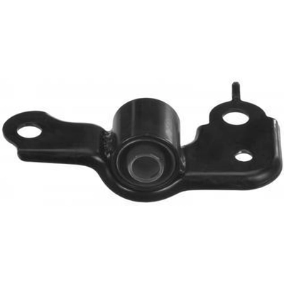 Control Arm Bushing Or Kit by DELPHI - TD1479W pa3