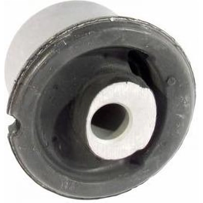 Lower Control Arm Bushing Or Kit by DELPHI - TD844W pa3