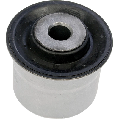 Radius Arm Bushing Or Kit by DORMAN (OE SOLUTIONS) - 533-958 pa2