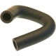 Purchase Top-Quality By Pass Hose by GATES - 19152 pa2