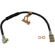 Purchase Top-Quality Front Brake Hose by DORMAN/FIRST STOP - H104352 pa5