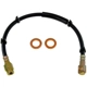 Purchase Top-Quality Front Brake Hose by DORMAN/FIRST STOP - H380303 pa1