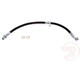 Purchase Top-Quality Front Brake Hose by RAYBESTOS - BH383606 pa3