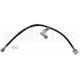 Purchase Top-Quality Front Brake Hose by SUNSONG NORTH AMERICA - 2201102 pa1