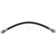 Purchase Top-Quality Front Brake Hose by SUNSONG NORTH AMERICA - 2203037 pa1