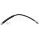 Purchase Top-Quality Front Brake Hose by SUNSONG NORTH AMERICA - 2203048 pa1