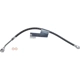 Purchase Top-Quality Front Brake Hose by SUNSONG NORTH AMERICA - 2203104 pa1