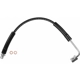 Purchase Top-Quality SUNSONG NORTH AMERICA - 2203739 - Front Brake Hose pa1