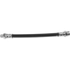 Purchase Top-Quality SUNSONG NORTH AMERICA - 2203996 - Brake Hydraulic Hose pa1