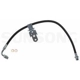 Purchase Top-Quality Front Brake Hose by SUNSONG NORTH AMERICA - 2204382 pa1