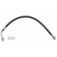 Purchase Top-Quality Front Brake Hose by SUNSONG NORTH AMERICA - 2204402 pa1