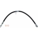 Purchase Top-Quality SUNSONG NORTH AMERICA - 2204668 - Brake Hydraulic Hose pa1