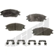 Purchase Top-Quality Front Ceramic Pads by AGNA BRAKES - CXD440 pa1