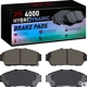 Purchase Top-Quality DYNAMIC FRICTION COMPANY - 4000-0617-00 - Front Hybrid Pads pa4
