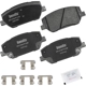 Purchase Top-Quality BENDIX - CFC2198 - Ceramic Front Disc Brake Pads pa1