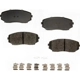 Purchase Top-Quality Front Semi Metallic Pads by AGNA BRAKES - ALD1258M pa2