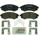 Purchase Top-Quality BOSCH - BP887 - Front Disc Brake Pads pa1