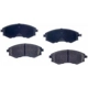 Purchase Top-Quality Front Semi Metallic Pads by RS PARTS - RSD449M pa1