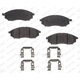 Purchase Top-Quality Front Semi Metallic Pads by RS PARTS - RSD888MH pa1