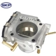 Purchase Top-Quality New Throttle Body by SKP - SKTB1060 pa4