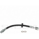 Purchase Top-Quality Rear Brake Hose by SUNSONG NORTH AMERICA - 2207154 pa1