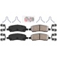 Purchase Top-Quality Rear Ceramic Pads by AMERIBRAKES - PRC1647 pa2