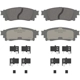 Purchase Top-Quality WAGNER - OEX1805 - Brake Pads pa1