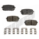 Purchase Top-Quality AGNA BRAKES - ALD1296M - Rear Semi Metallic Pads pa1