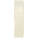 Purchase Top-Quality Shifter Bushing Kit by URO - 1112670086 pa5