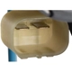 Purchase Top-Quality Regulateur de vitre avec moteur de ACI/MAXAIR - 383438 pa2